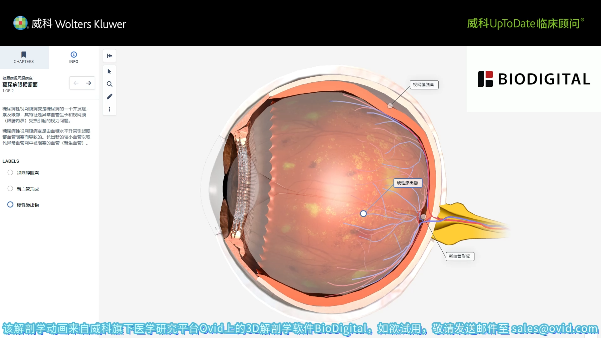 内分泌学和糖尿病新进展|长间隔玻璃体内注射阿柏西普治疗糖尿病性