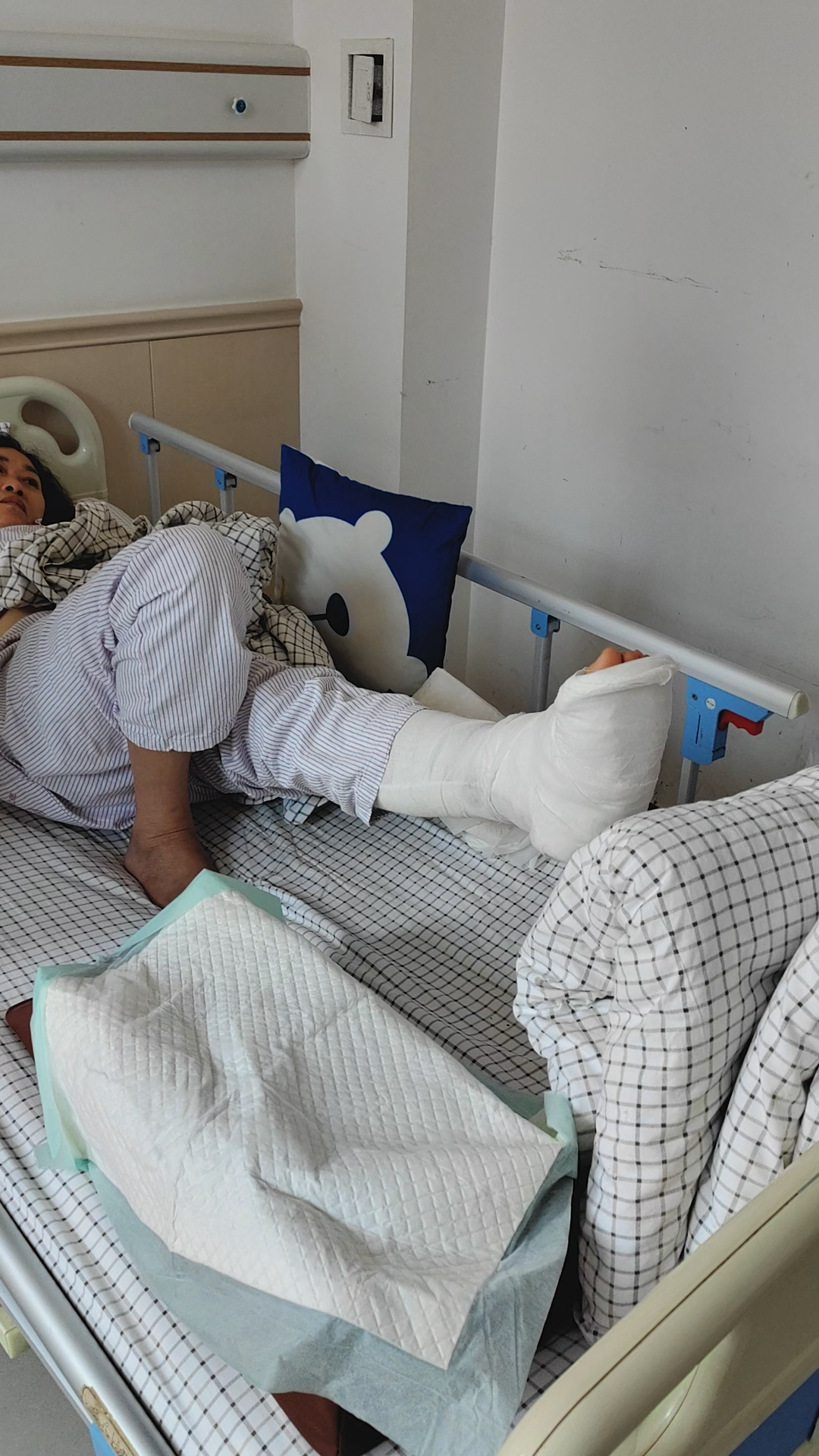 踝关节骨折并半脱位一例